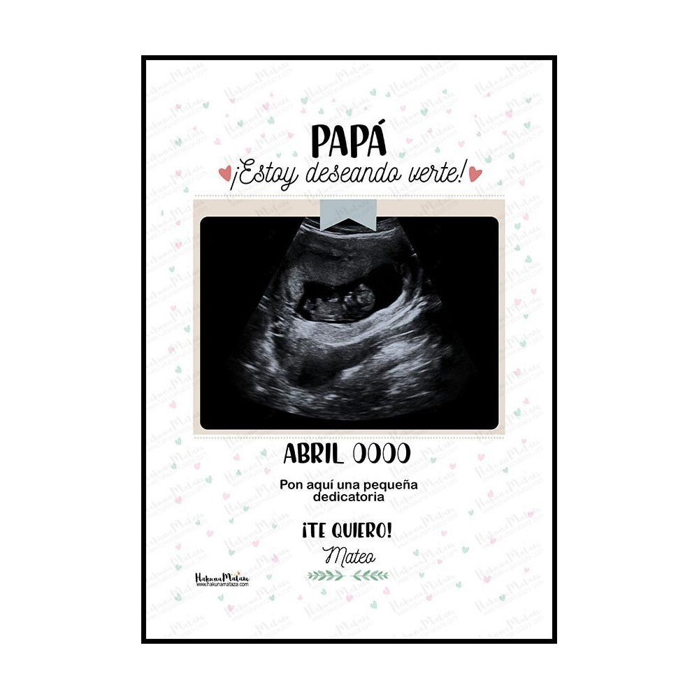 Diseño completo de la lámina personalizada con foto “Ecografía”.