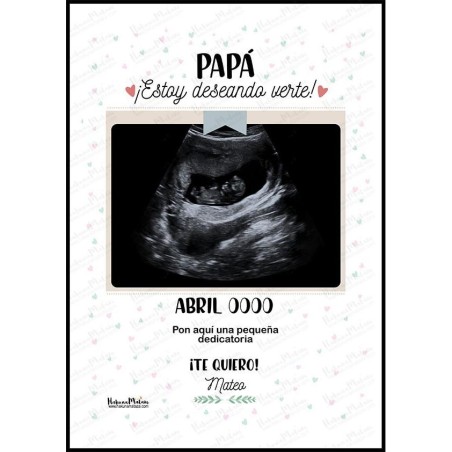 Lámina personalizada con foto - Ecografía Lámina personalizada con foto - Ecografía