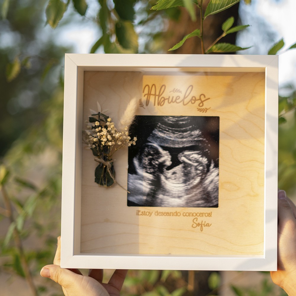 Marco de fotos personalizado - Ecografía