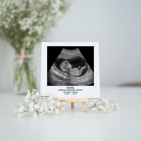 Azulejo personalizado - Ecografía